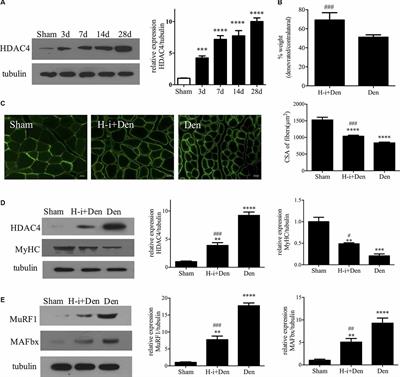 HDAC4 Knockdown Alleviates Denervation-Induced Muscle Atrophy by Inhibiting Myogenin-Dependent Atrogene Activation